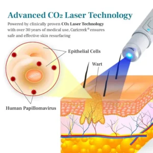 Curicreek® LumeSkin Mole and Wart Removal Laser Pen 2