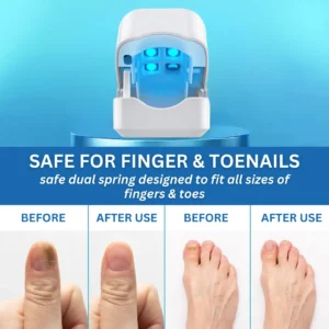 Curicreek® Nail Fungus Laser Treatment Device
