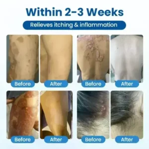 Cougex® PCA Magnesium Deep Repair Spray