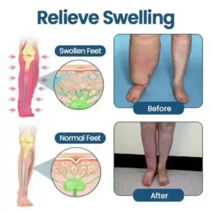 Cougex® Roll-On Pump Cream for Lymphatic Drainage & Swelling Relief