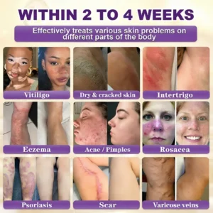 QIAWI® Biotin 10-in-1 Skin Restoration Cream