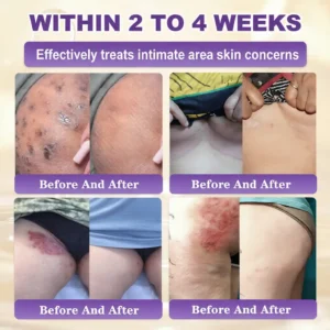 QIAWI® Biotin 10-in-1 Skin Restoration Cream